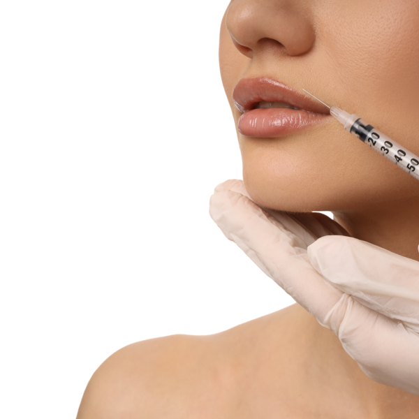 estetica filler labbra foto