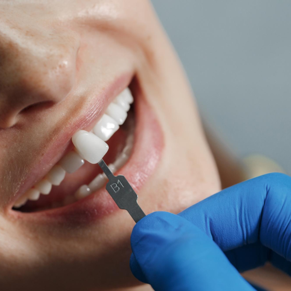 odontoiatria estetica foto